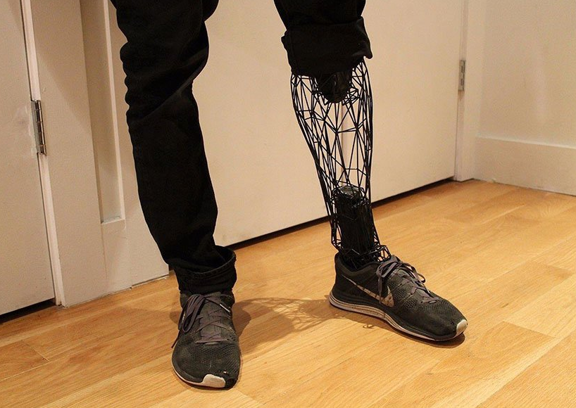 3D Printing in Healthcare: Revolutionizing Patient Care