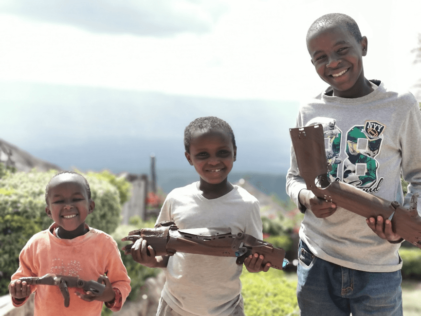 Child with 3D printed arm