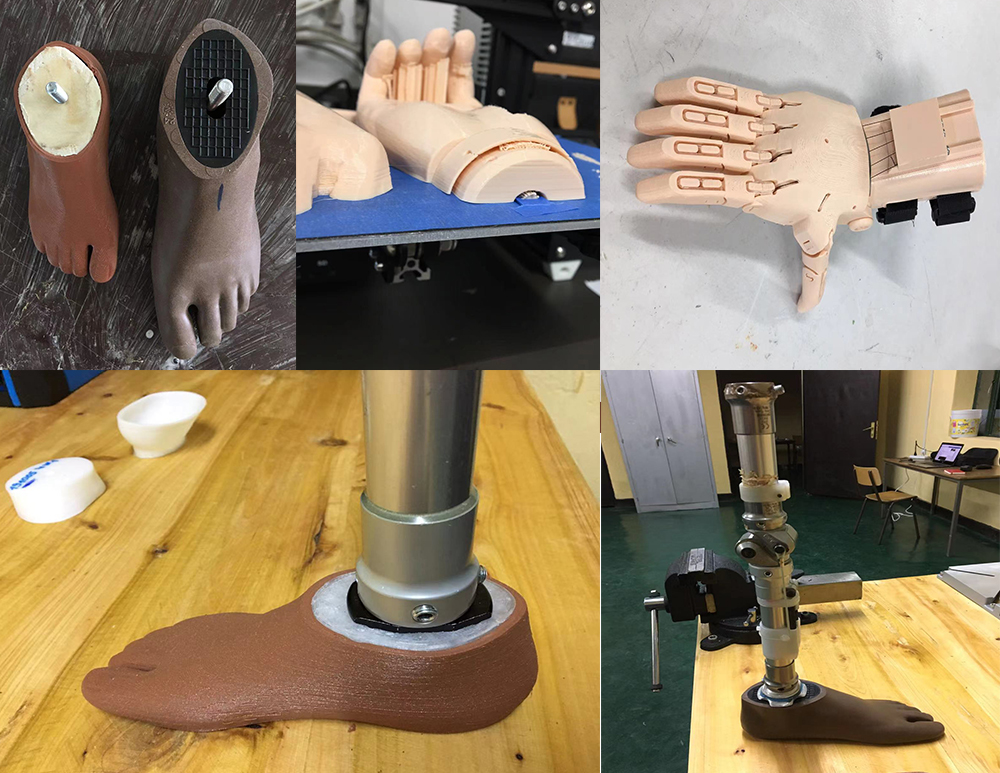3d printing prosthetics and orthotic devices