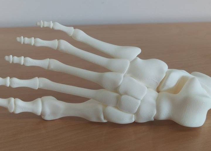 Is It Possible to 3D Print Bones? From DIY Models to Real Medical Science